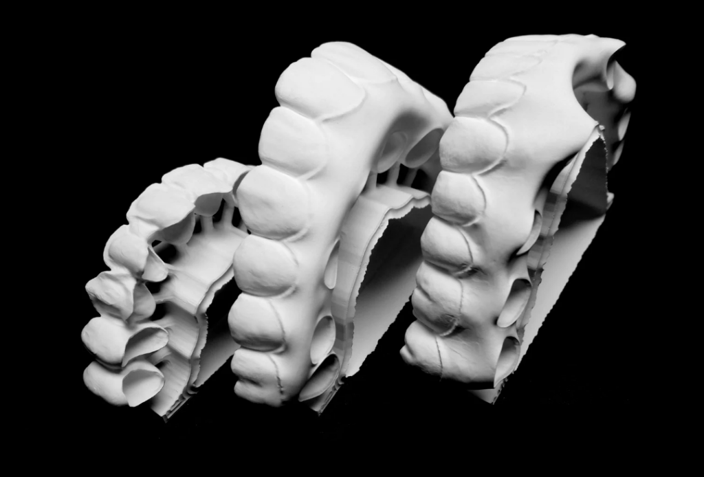 Couronnes et bridges en zirconium multicouche à Marrakech - ELWAFA DENTAL